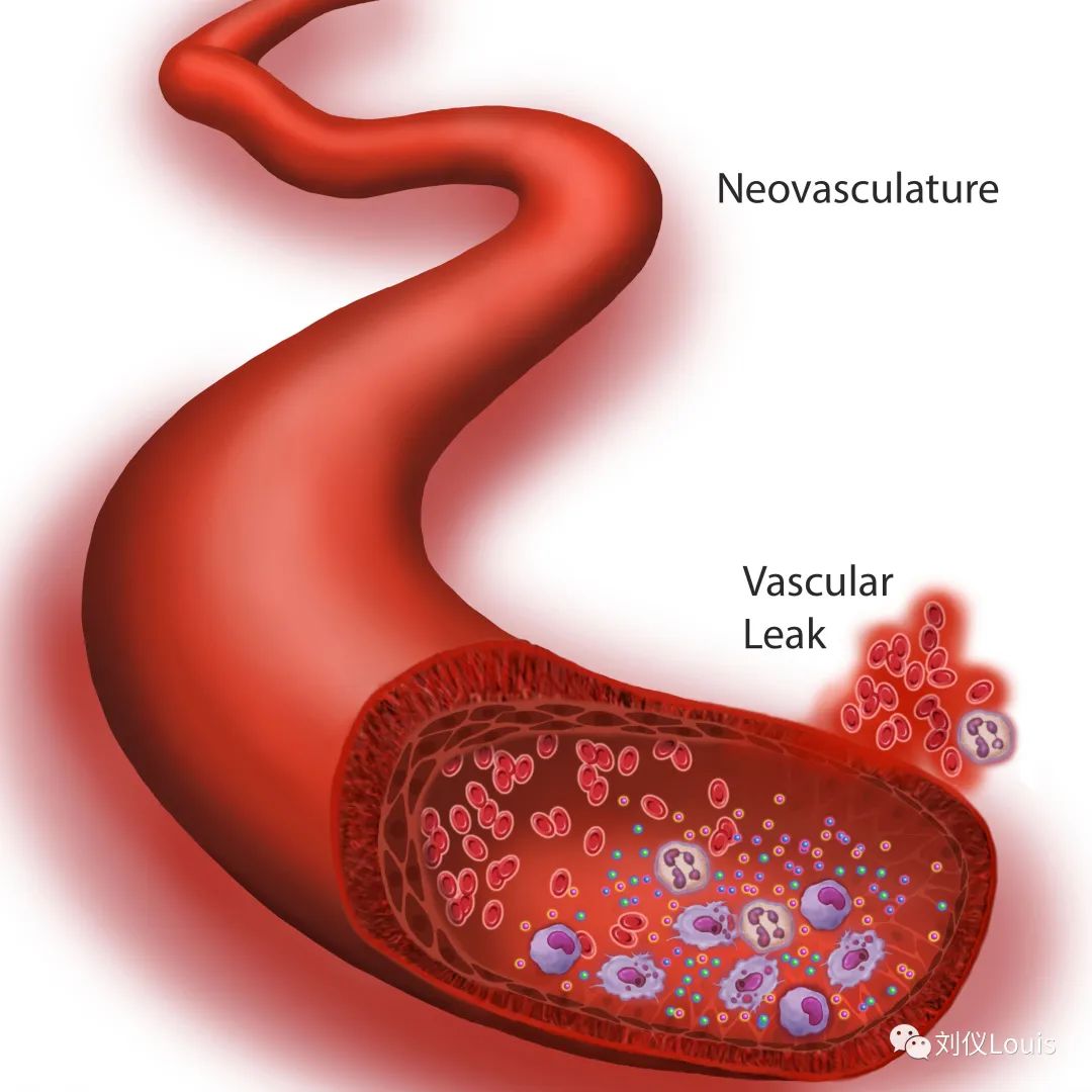 f31dd35b3806d7d395f5b24315ecb205.jpg f31dd35b3806d7d395f5b24315ecb205.jpg